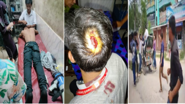 বৈষম্যবিরোধী ছাত্রদের ওপর ছাত্রদলের হামলা, আহত ৩