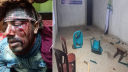 নোয়াখালীতে বিএনপির কার্যালয়ে আ.লীগের হামলা, আহত ৪