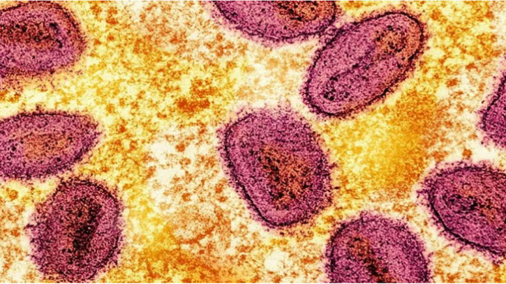 আফ্রিকায় মারবার্গ ভাইরাসের প্রাদুর্ভাব, ইথিওপিয়ায় আক্রান্ত ৯