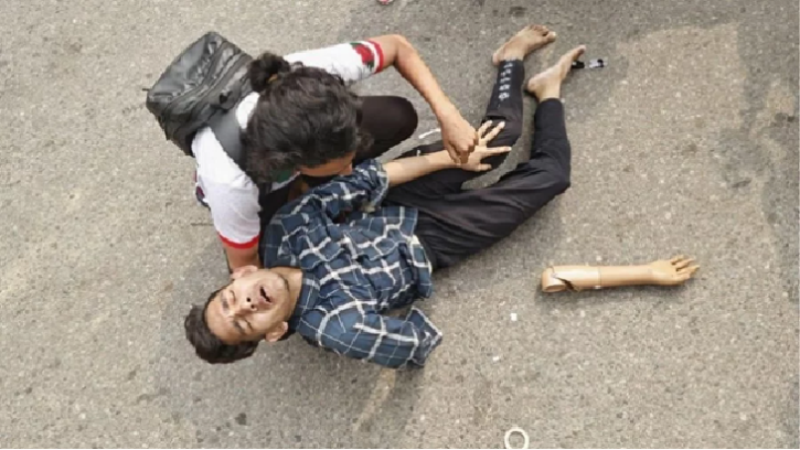 পুলিশের লাঠিচার্জে পড়ে গেল ‘জুলাই যোদ্ধার’ কৃত্রিম হাত