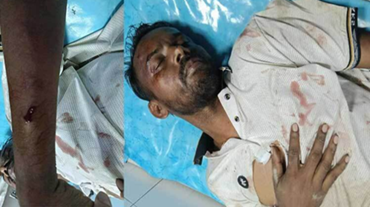 হিরো আলম হামলার শিকার রাজধানীর রামপুরায়