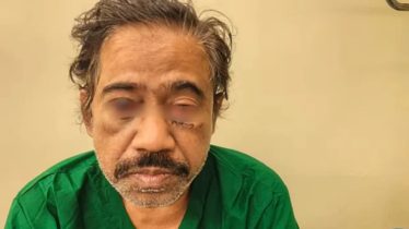 চাঁদা না পেয়ে ঢামেক চিকিৎসকের ওপর হামলা চাঁদা না পেয়ে ঢামেক চিকিৎসকের ওপর হামলা