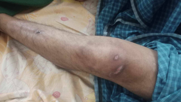 জিইউকে মাদকাসক্ত কেন্দ্রে যুবককে অমানবিক নির্যাতন