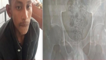 পেটভর্তি ইয়াবাসহ শার্শার মাসুদ রানা আটক