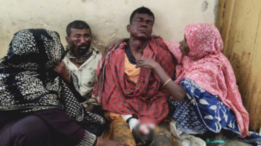 যশোরের শার্শায় মাটি কাটার সময় বোমা বিস্ফোরণ, আহত ২ শ্রমিক