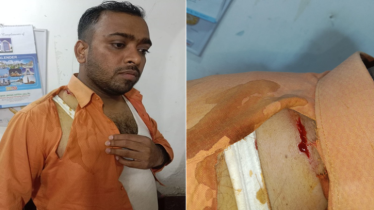 এনসিপি প্রার্থীর কেন্দ্রের প্রধান এজেন্টকে কুপিয়ে আহত