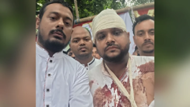 রক্তাক্ত ছবি শেয়ার করে বিচার চাইলেন নাসীরুদ্দিন পাটওয়ারী
