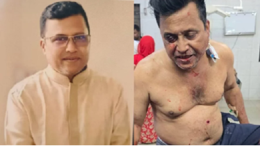 কুষ্টিয়ায় আওয়ামী লীগ নেতা আজম গুলিবিদ্ধ