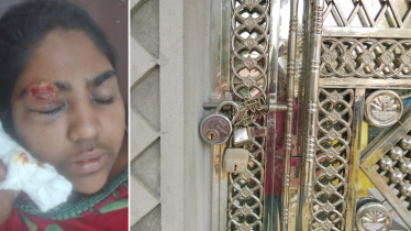 বীরগঞ্জে জমি দখলের চেষ্টায় হামলা, নারী-শিশুসহ আহত ৪