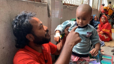 যশোরে হামের প্রাদুর্ভাবের শঙ্কায় সতর্ক স্বাস্থ্য বিভাগ