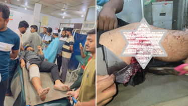 নোয়াখালীতে জামায়াত কর্মী গুলিবিদ্ধ